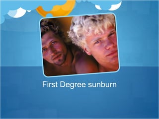 First Degree sunburn
 