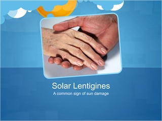 A common sign of sun damage
Solar Lentigines
 