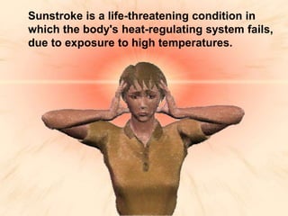 Sunstroke and it's Management - Dr.S.Gopakumar,Atreya Awardee | PPT
