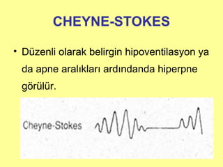 CHEYNE-STOKES
• Düzenli olarak belirgin hipoventilasyon ya
da apne aralıkları ardındanda hiperpne
görülür.
 