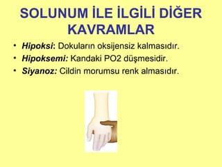 SOLUNUM İLE İLGİLİ DİĞER
KAVRAMLAR
• Hipoksi: Dokuların oksijensiz kalmasıdır.
• Hipoksemi: Kandaki PO2 düşmesidir.
• Siyanoz: Cildin morumsu renk almasıdır.
 