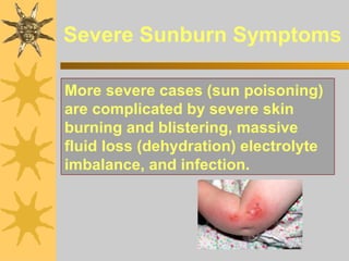 Sun Wise | PPT
