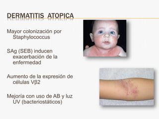 DERMATITIS ATOPICA
Mayor colonización por
Staphylococcus
SAg (SEB) inducen
exacerbación de la
enfermedad
Aumento de la expresión de
células Vβ2
Mejoría con uso de AB y luz
UV (bacteriostáticos)
 