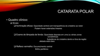 CATARATA POLAR
• Quadro clínico:
 Sinais:
 Iluminação difusa: Opacidade central com transparência do cristalino ao redor
Podem haver extensões lineares
 Exame de lâmpada de fenda: Opacidade disposta em uma ou várias zonas
concêntricas
Substância do cristalino dentro e fora da região
afetada está clara.
 Reflexo vermelho: Escurecimento central
Brilho periférico
 
