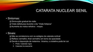 CATARATA NUCLEAR SENIL
• Sintomas:
 Diminuição gradual da visão
 Visão defeituosa durante o dia “Visão fotópica”
 Aumento do índice refrativo : miopia
• Sinais:
 Não se correlaciona com os estágios da catarata cortical
 Reflexo vermelho: Anel vermelho em torno da opacidade
 Devido à deposição de melanina : tirosina, o cristalino pode ter cor
1. Preto: Catarata nigra
2. Catarata brunescente
 