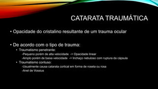 CATARATA TRAUMÁTICA
• Opacidade do cristalino resultante de um trauma ocular
• De acordo com o tipo de trauma:
• Traumatismo penetrante:
-Pequeno porém de alta velocidade -> Opacidade linear
-Amplo porém de baixa velocidade -> Inchaço nebuloso com ruptura da cápsula
• Traumatismo contuso:
-Usualmente causa catarata cortical em forma de roseta ou rosa
-Anel de Vossius
 