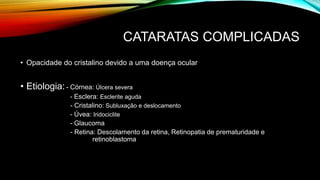 CATARATAS COMPLICADAS
• Opacidade do cristalino devido a uma doença ocular
• Etiologia:- Córnea: Úlcera severa
- Esclera: Esclerite aguda
- Cristalino: Subluxação e deslocamento
- Úvea: Iridociclite
- Glaucoma
- Retina: Descolamento da retina, Retinopatia de prematuridade e
retinoblastoma
 