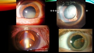 +++----------------------+
 