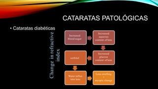 CATARATAS PATOLÓGICAS
• Cataratas diabéticas
Increased
blood sugar
Increased
aqueous
content of lens
Increased
glucose
content of lens
sorbitol
Water influx
into lens
Lens swelling
+
myopic change
Change
in
refractive
index
 