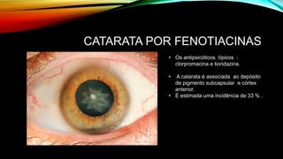 CATARATA POR FENOTIACINAS
• Os antipsicóticos típicos :
clorpromacina e tioridazina.
• A catarata é associada ao depósito
de pigmento subcapsular e córtex
anterior.
• É estimada uma incidência de 33 % .
 