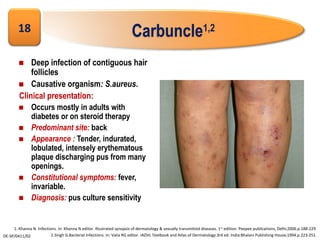 Superficial bacterial infection | PPT