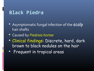 Black Piedra

 Asymptomatic fungal infection of the scalp
  hair shafts
 Caused by Piedraia hortae
 Clinical findings: Discrete, hard, dark
  brown to black nodules on the hair
 Frequent in tropical areas
 