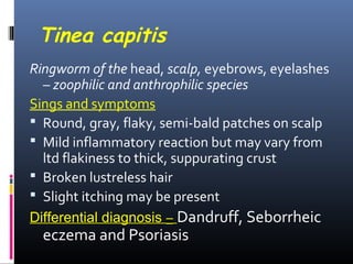 Tinea capitis
Ringworm of the head, scalp, eyebrows, eyelashes
  – zoophilic and anthrophilic species
Sings and symptoms
 Round, gray, flaky, semi-bald patches on scalp
 Mild inflammatory reaction but may vary from
  ltd flakiness to thick, suppurating crust
 Broken lustreless hair
 Slight itching may be present
Differential diagnosis – Dandruff, Seborrheic
  eczema and Psoriasis
 