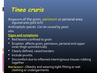 Tinea cruris
Ringworm of the groin, perineum or perianal area.
   inguinal area (jock itch)
Anthrophylic species. Can be caused by yeast
also.
Signs and symptoms
 Red lesions confined to groin
 Eruption affects groin, perineum, perianal and upper
   inner thigh symmetrically
 Clearly defined, raised borders
 Include pruritis
 Discomfort due to inflamed intertriginous tissues rubbing
   together
Risk factors? – Obesity and wearing tight-fitting or wet
   clothing or undergarments
 