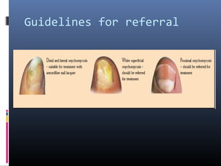 Guidelines for referral
 