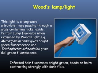 Wood’s lamp/light

This light is a long-wave
ultraviolet rays passing through a
glass containing nickel oxide.
Certain fungi fluoresce when
examined by Wood’s light e.g.
Microsporum canis gives bright
green fluorescence and
Trichophyton schoenleinii gives
dull green fluorescence.


     Infected hair fluoresces bright green, beads on hairs
     contrasting strongly with dark field.
 