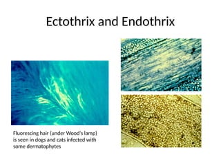Comprehensive Overview of Superficial Fungal Infections and Their ...