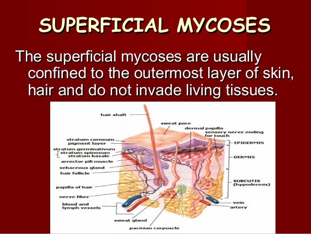superficial mycoses
