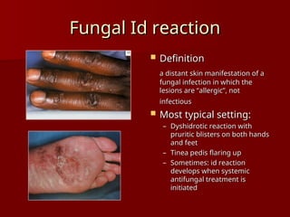 Superficial mycoses common in medical dermatology | PPT