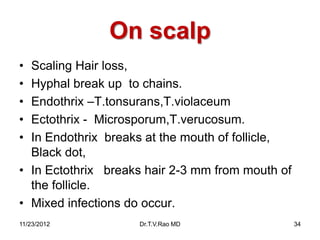 Superficial Fungal Infections | PPTX