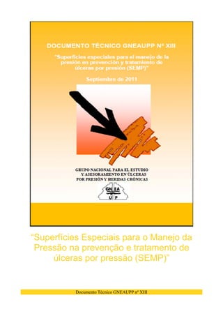 Documento Técnico GNEAUPP nº XIII
“Superfícies Especiais para o Manejo da
Pressão na prevenção e tratamento de
úlceras por pressão (SEMP)”
 