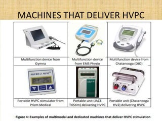 MACHINES THAT DELIVER HVPC
 