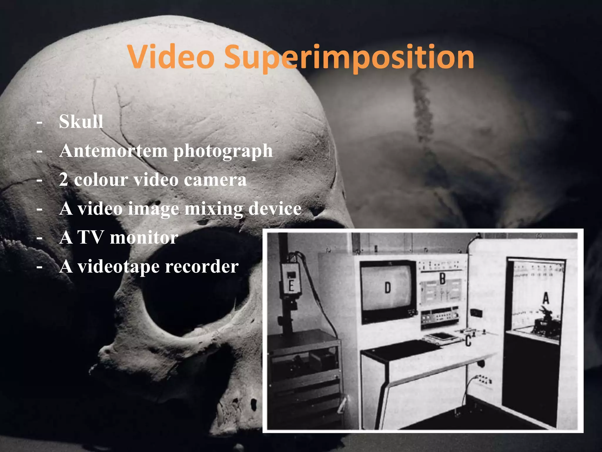 Video Superimposition
- Skull
- Antemortem photograph
- 2 colour video camera
- A video image mixing device
- A TV monitor
- A videotape recorder
 