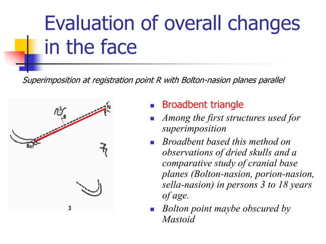 ORTHODONTICS SUPERIMPOSITION_TECHNIQUES.ppt