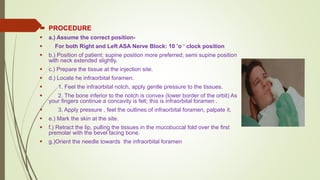 Superior Alveolar Nerve Block.pptx