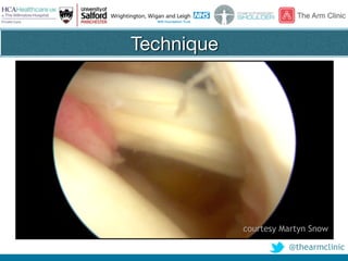 @thearmclinic
Technique
courtesy Martyn Snow
 