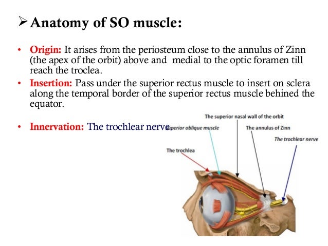 Superior oblique palsy