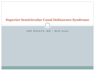 A D E W I J A Y A , M D – M A Y 2 0 2 0
Superior Semicircular Canal Dehiscence Syndrome
 