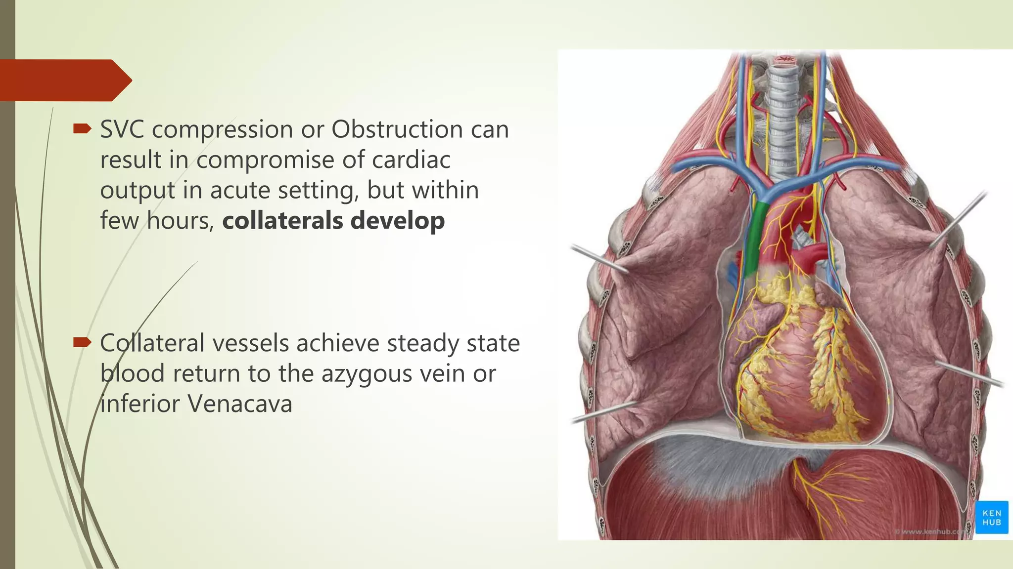 Svc Compression Sign Superior Vena Cava Syndrome | PPTX