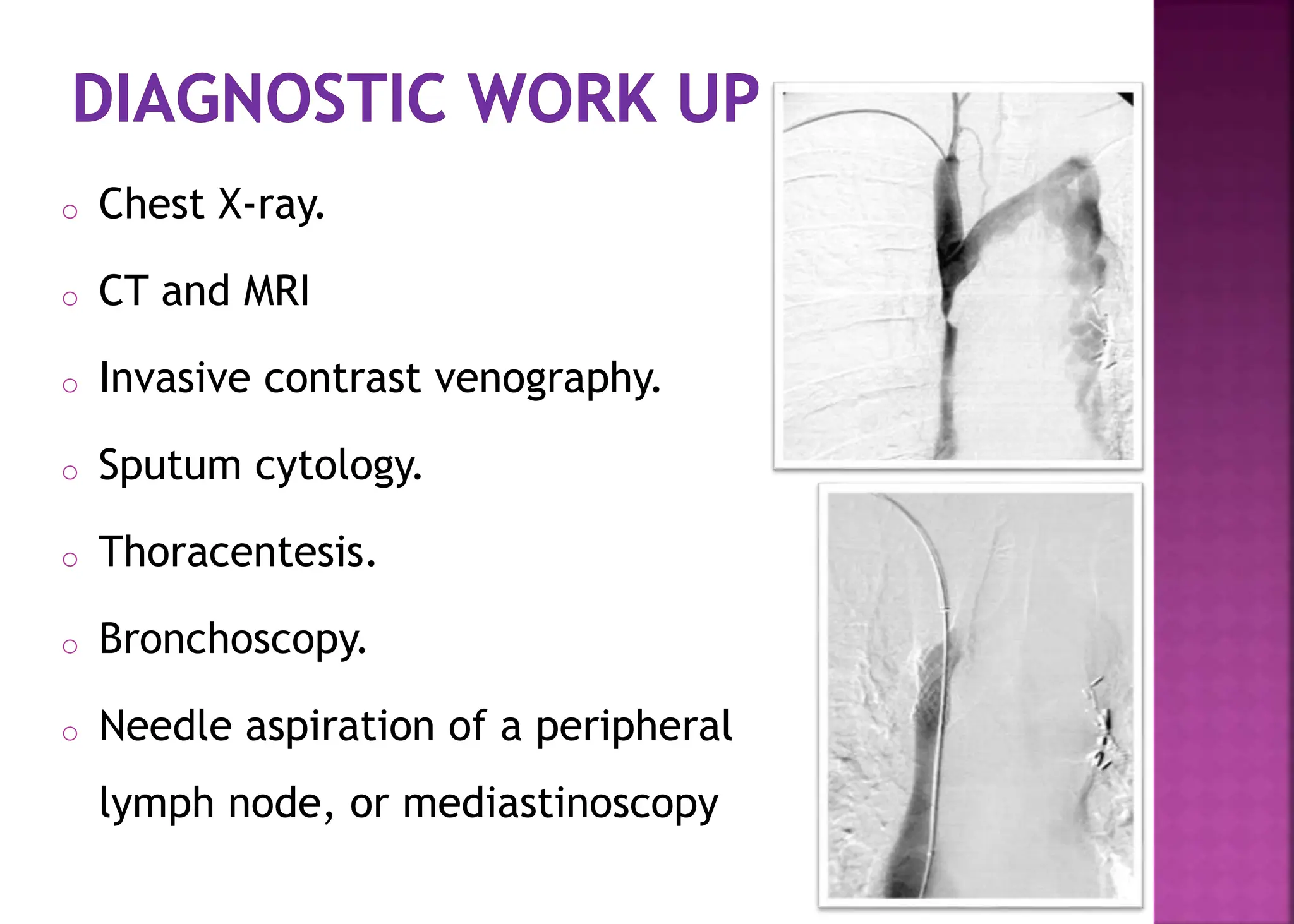 Superior Vena Cava Syndrome. Etiology and management | PPTX