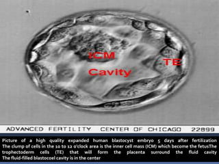 Picture of a high quality expanded human blastocyst embryo 5 days after fertilization
The clump of cells in the 10 to 12 o'clock area is the inner cell mass (ICM) which become the fetusThe
trophectoderm cells (TE) that will form the placenta surround the fluid cavity
The fluid-filled blastocoel cavity is in the center
 