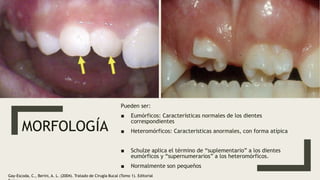 MORFOLOGÍA
Pueden ser:
■ Eumórficos: Características normales de los dientes
correspondientes
■ Heteromórficos: Caracteris...