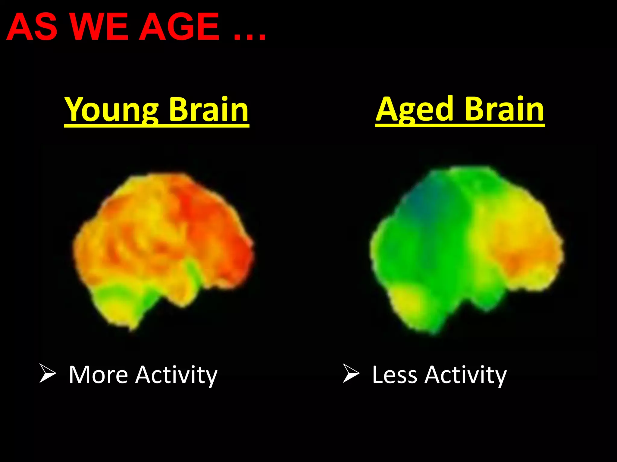 AS WE AGE …

   Young Brain        Aged Brain




  More Activity    Less Activity
 