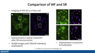 Superresolution Correlative Light and Electron Microscopy - DELMIC | PDF