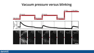 Superresolution Correlative Light and Electron Microscopy - DELMIC | PDF