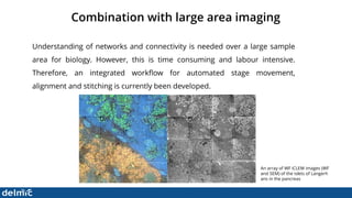 Superresolution Correlative Light and Electron Microscopy - DELMIC | PDF