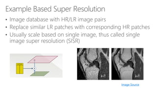 Scaling up Deep Learning Based Super Resolution Algorithms | PDF