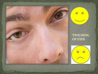 TWICHING
OF EYES
 