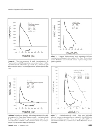 Manobras expiratórias forçadas em lactentes




                                                                    Figura 12 – Lactente sibilante de um ano e três meses recebendo
                                                                    medicação profilática e testado na intercrise. Curva fluxo-volume
                                                                    dentro dos limites da normalidade. Valores expressos em percenta-
Figura 11 – Criança de dois anos de idade com diagnóstico de        gem do previsto.
Pneumonite Intersticial Descamativa. A curva fluxo-volume eviden-
cia uma acentuada redução da Capacidade Vital, com preservação
dos fluxos expiratórios. Valores expressos em percentagem do pre-
visto.




Figura 13 – Criança de 19 meses, portadora de Bronquiolite Obli-    Figura 14 – Lactente portador de Fibrose Cística. Testes realizados
terante pós-viral. Capacidade Vital preservada e marcada redução    durante internação por exacerbação respiratória (nov 2000) com
de fluxos expiratórios. Valores expressos em percentagem do pre-    fluxos expiratórios reduzidos e cinco meses após (abril 2001), cli-
visto. Observa-se também acentuada concavidade da curva expi-       nicamente assintomático, com resultados dentro dos limites da nor-
ratória, característica de doenças obstrutivas.                     malidade.

J Pneumol 28(Supl 3) – outubro de 2002                                                                                         S 229
 