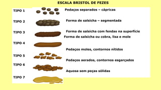 TIPO 1
TIPO 2
TIPO 3
TIPO 4
TIPO 5
TIPO 6
TIPO 7
Pedaços separados – cápricas
Forma de salsicha – segmentada
Forma de salsicha com fendas na superfície
Forma de salsicha ou cobra, lisa e mole
Pedaços moles, contornos nítidos
Pedaços aerados, contornos esgarçados
Aquosa sem peças sólidas
ESCALA BRISTOL DE FEZES
 