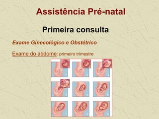 Assistência Pré-natal
Primeira consulta
Exame Ginecológico e Obstétrico
Exame do abdome: primeiro trimestre
 
