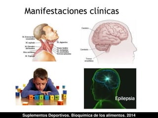 Manifestaciones clínicas 
Suplementos Deportivos. Bioquímica de los alimentos. 2014 
 