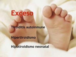 Tiroiditis autoinmune
Hipertiroidismo
Hipotiroidismo neonatal
 