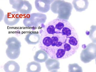 Enmascaramiento de
anemia perniciosa
 