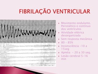  Movimento ondulante.
Peristáltico e contínuo
dos ventrículos
 Atividade elétrica
desorganizada
 Sem resposta mecânica
 80 – 85%
 Inconsciência -10 a
15seg
 Apnéia - 20 a 30 seg.
 Lesão cerebral 5-16
min
 