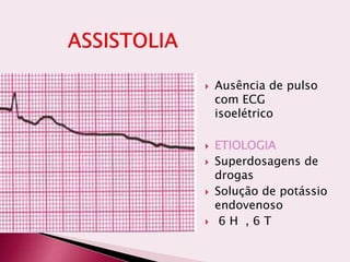  Ausência de pulso
com ECG
isoelétrico
 ETIOLOGIA
 Superdosagens de
drogas
 Solução de potássio
endovenoso
 6 H , 6 T
 